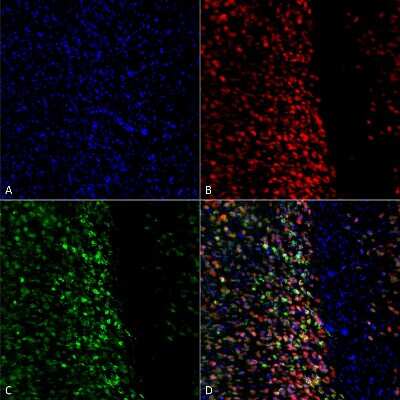 Immunocytochemistry/ Immunofluorescence: alpha-Synuclein [p Ser129] Antibody [NBP2-61121]